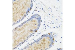 Immunohistochemistry of paraffin-embedded human rectum using ST antibody (ABIN6128538, ABIN6148573, ABIN6148574 and ABIN6222755) at dilution of 1:100 (40x lens). (STAT4 antibody  (AA 569-748))