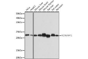 Western blot analysis of extracts of various cell lines, using TCTP/TPT1 Rabbit mAb (ABIN7271101) at 1:1000 dilution. (TPT1 antibody)