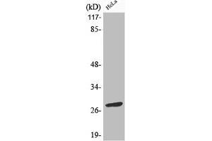 Western Blot analysis of HeLa cells using Phospho-Bcl-2 (S70) Polyclonal Antibody (Bcl-2 antibody  (pSer70))