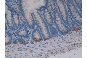 DAB staining on IHC-P; Samples: Rat Intestine Tissue (Osteopontin antibody  (AA 17-317))