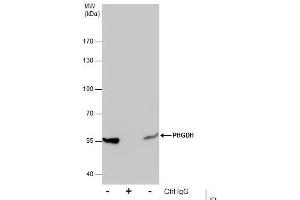 Immunoprecipitation (IP) image for anti-phosphoglycerate Dehydrogenase (PHGDH) (N-Term) antibody (ABIN2855237)