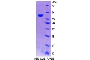 SDS-PAGE analysis of Human RNASEH2A Protein.