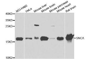 Western blot analysis of extracts of various cell lines, using SNCA antibody. (SNCA antibody  (AA 61-140))