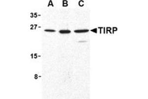 Western blot analysis of TIRP in human (A), mouse (B), and rat (C) kidney cell lysates with this product at 1 μg/ml. (TICAM2 antibody  (C-Term))