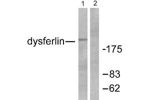 Western Blotting (WB) image for anti-Dysferlin (DYSF) (C-Term) antibody (ABIN1848514) (Dysferlin antibody  (C-Term))