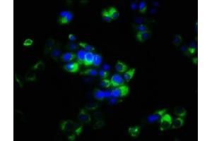 Immunofluorescence staining of PC-3 cells with ABIN7166152 at 1:266, counter-stained with DAPI. (SPRY4 antibody  (AA 1-299))