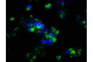 Immunofluorescence staining of PC-3 cells with ABIN7166152 at 1:266, counter-stained with DAPI.