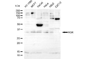 anti-Retinal G Protein Coupled Receptor (RGR) antibody