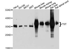 Western blot analysis of extracts of various cell lines, using TST antibody (ABIN4905513) at 1:1000 dilution. (TST antibody)