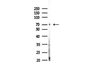 anti-EPXH2 (C-Term) antibody
