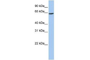 WB Suggested Anti-SLC13A2 Antibody Titration:  0. (SLC13A2 antibody  (Middle Region))