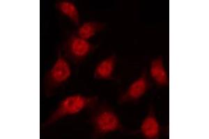 ABIN6267454 staining K562 by IF/ICC. (MKP-1/2 antibody  (pSer296, pSer318))