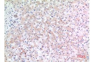 Immunohistochemistry (IHC) analysis of paraffin-embedded Human Liver, antibody was diluted at 1:100. (CD166 antibody  (C-Term))