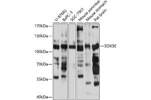 Western blot analysis of extracts of various cell lines, using SOX30 antibody (ABIN6131031, ABIN6148300, ABIN6148302 and ABIN6215454) at 1:1000 dilution.