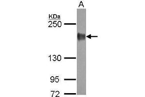 WB Image Sample (30 ug of whole cell lysate) A: A431 5% SDS PAGE antibody diluted at 1:10000 (EGFR antibody  (C-Term))