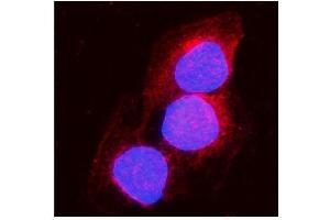 IF analysis of Aconitase 1/ACO1 using anti-Aconitase 1/ACO1 antibody (ABIN7598988). (Aconitase 1 antibody  (AA 1-137))