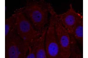Immunofluorescence staining of methanol-fixed HeLa cells usingα-Synuclein (phospho-Tyr133) antibody (E011285, Red) (SNCA antibody  (pTyr133))