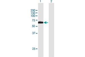 Western Blot analysis of RPN2 expression in transfected 293T cell line by RPN2 MaxPab polyclonal antibody. (Ribophorin II antibody  (AA 1-631))