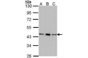 WB Image Sample (30 ug of whole cell lysate) A: 293T B: A431 , C: H1299 10% SDS PAGE antibody diluted at 1:1000 (AHSA1 antibody  (Center))