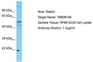Host: Rabbit Target Name: TMEM145 Sample Type: RPMI-8226 Whole Cell lysates Antibody Dilution: 1. (TMEM145 antibody  (N-Term))