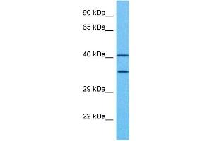 Host:  Rabbit  Target Name:  PAX2  Sample Tissue:  Human Ovary Tumor  Antibody Dilution:  1ug/ml (PAX2A antibody  (Middle Region))