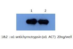 Western Blotting (WB) image for anti-serpin Peptidase Inhibitor, Clade A (Alpha-1 Antiproteinase, Antitrypsin), Member 3 (SERPINA3) antibody (ABIN1105309) (SERPINA3 antibody)