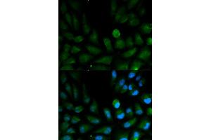 Immunofluorescence analysis of HepG2 cells using CAPZA2 antibody. (CAPZA2 antibody)