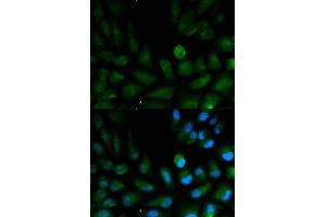 Immunofluorescence analysis of HepG2 cells using CAPZA2 antibody. (CAPZA2 antibody)
