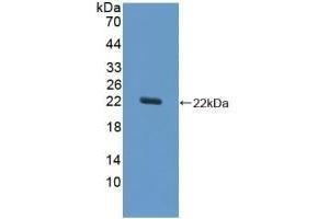 Detection of Recombinant SOD1, Equine using Polyclonal Antibody to Superoxide Dismutase 1 (SOD1) (SOD1 antibody  (AA 2-154))