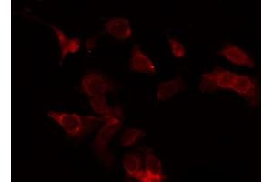 ABIN6273946 staining Hela by IF/ICC. (LGR5 antibody  (Internal Region))
