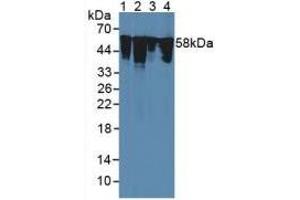 Western Blotting (WB) image for Vimentin (VIM) ELISA Kit (ABIN6574248)