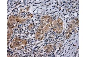 Immunohistochemical staining of paraffin-embedded Kidney tissue using anti-LIPG mouse monoclonal antibody. (LIPG antibody)