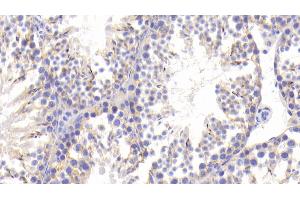 Detection of MAP1B in Mouse Testis Tissue using Polyclonal Antibody to Microtubule Associated Protein 1B (MAP1B) (MAP1B antibody  (AA 2203-2464))