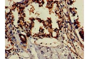Immunohistochemistry of paraffin-embedded human lung tissue using ABIN7147139 at dilution of 1:100 (ITGB1 antibody  (AA 297-380))