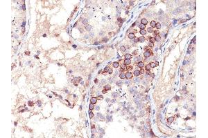 Formalin-fixed, paraffin-embedded human Testicular Carcinoma stained with MAGE-1 Mouse Monoclonal Antibody (MA454). (MAGEA1 antibody)