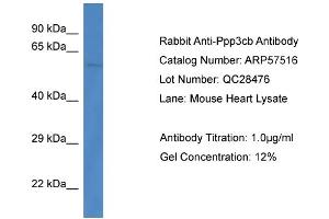 Western Blotting (WB) image for anti-Protein Phosphatase 3, Catalytic Subunit, beta Isozyme (PPP3CB) (C-Term) antibody (ABIN785907) (PPP3CB antibody  (C-Term))