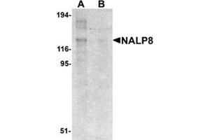 Western blot analysis of NALP8 in human colon tissue lysate with NALP8 antibody at 1 μg/ml in (A) the absence and (B) the presence of blocking peptide.
