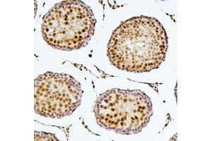 IHC analysis of SOX15 using anti-SOX15 antibody (ABIN6719624). (SOX15 antibody  (AA 1-233))