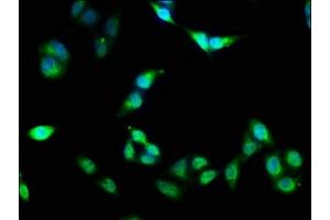 Immunofluorescence staining of Hela cells with ABIN7162837 at 1:133, counter-stained with DAPI. (FKBP4 antibody  (AA 1-240))