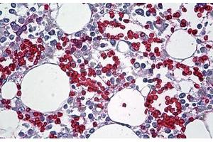 Human Bone Marrow: Formalin-Fixed, Paraffin-Embedded (FFPE) (Red Blood Cell antibody)
