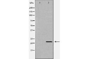 Western blot analysis of extracts of mouse livertissue, using IFNA1 antibody. (IFNA1 antibody  (Internal Region))
