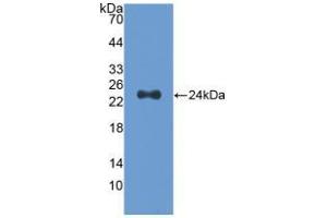 Western blot analysis of recombinant Human Slit2. (SLIT2 antibody  (AA 1160-1333))
