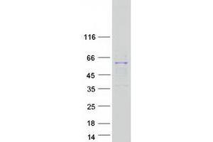 Validation with Western Blot (RRP8 Protein (Myc-DYKDDDDK Tag))