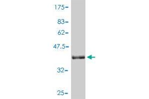 Western Blot detection against Immunogen (39. (SNRPD2 antibody  (AA 1-118))
