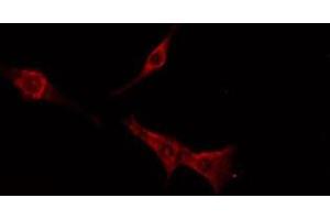 TAS2R16 antibody  (Internal Region)