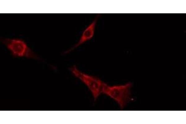TAS2R16 antibody  (Internal Region)