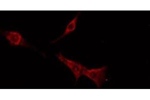 ABIN6276222 staining  MCF7 cells by IF/ICC. (TAS2R16 antibody  (Internal Region))