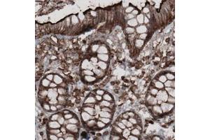 Immunohistochemical staining (Formalin-fixed paraffin-embedded sections) of human colon with EZR monoclonal antibody, clone CL2360  shows strong membranous combined with moderate cytoplasmic immunoreactivity in glandular epithelium and lamina propria cells. (Ezrin antibody)