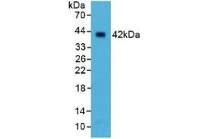 Detection of SELL in Human Liver Tissue using Polyclonal Antibody to Selectin, Leukocyte (SELL) (L-Selectin antibody  (AA 109-346))