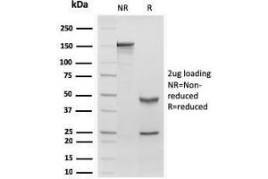SDS-PAGE Analysis Purified RBP1 Recombinant Mouse Monoclonal Antibody (rRBP1/872).
